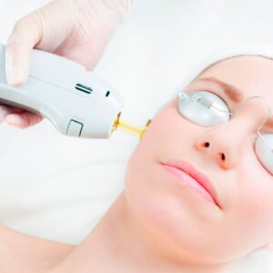 Face Laser