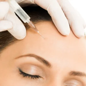 Forehead Meso Botox